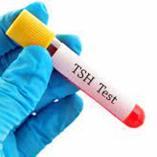 Thyroid Stimulating Hormone (TSH) Test 1S Pharma