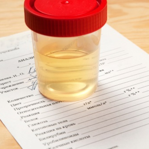24HR Urine Protein Test 1S Pharma
