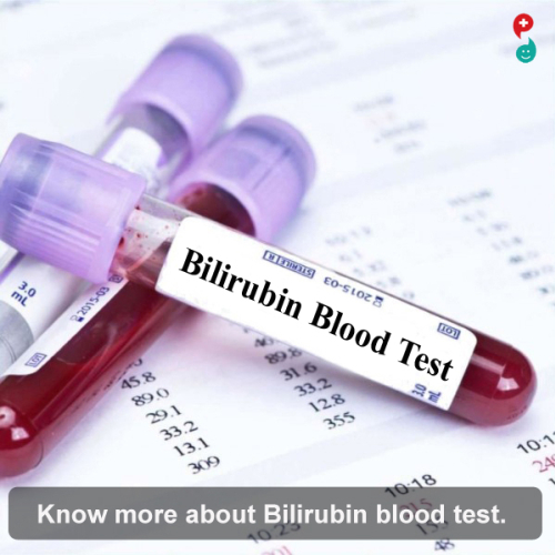 Total Bilirubin Test 1S Pharma