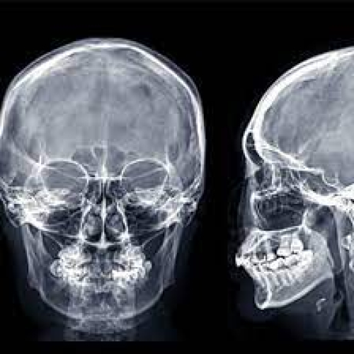 Xray Of Skull (AP+LAT) Test 1S Pharma