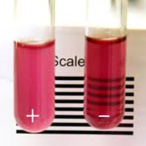 Sickling Test 1S Pharma